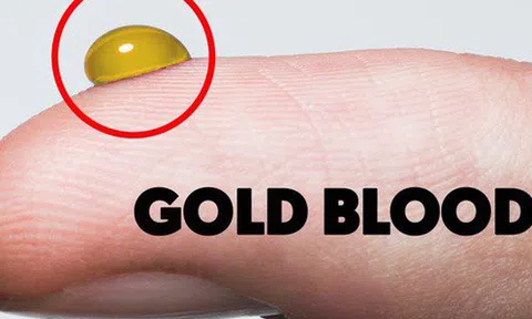 Kinh ngạc với nhóm máu được ví với "vàng ròng", và chỉ 43 người trên thế giới có nó