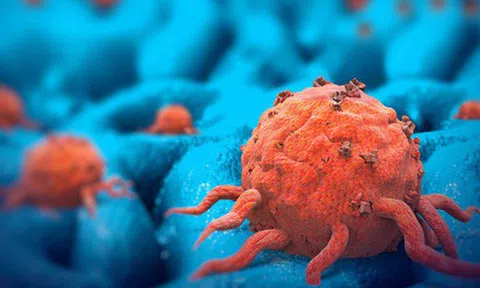 "Mầm" ung thư ẩn náu ở 7 loại thực phẩm: Nếu không muốn mắc bệnh, bạn nên đặc biệt chú ý!