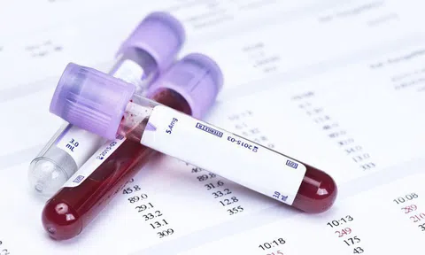 Startup được Bill Gates hậu thuẫn vừa tạo ra phương pháp sàng lọc ung thư qua mẫu máu và nước tiểu, không cần làm thủ thuật xâm lấn