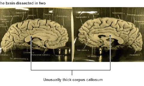 Những chuyện chưa kể về bộ não Einstein