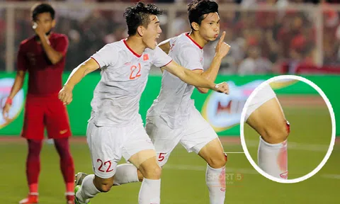 Văn Hậu ghi bàn khi vết thương còn đang đổ máu: Chiến binh "khổng lồ" của U22 Việt Nam